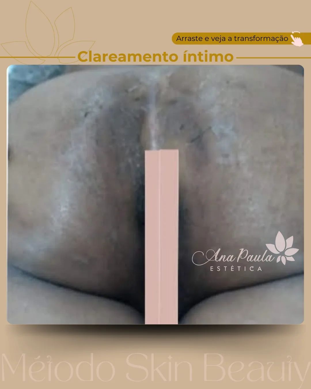 Slider Antes e Depois