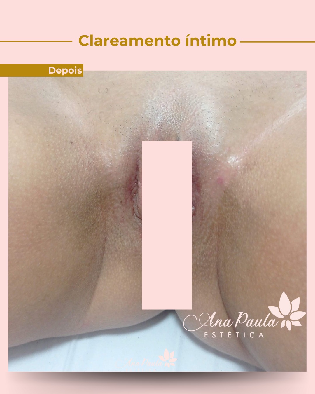 Slider Antes e Depois