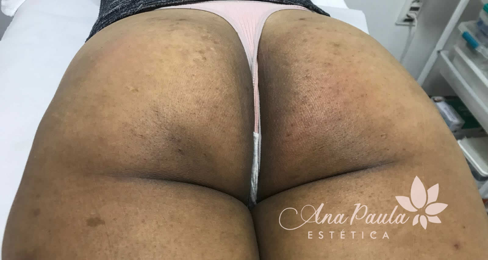 Slider Antes e Depois