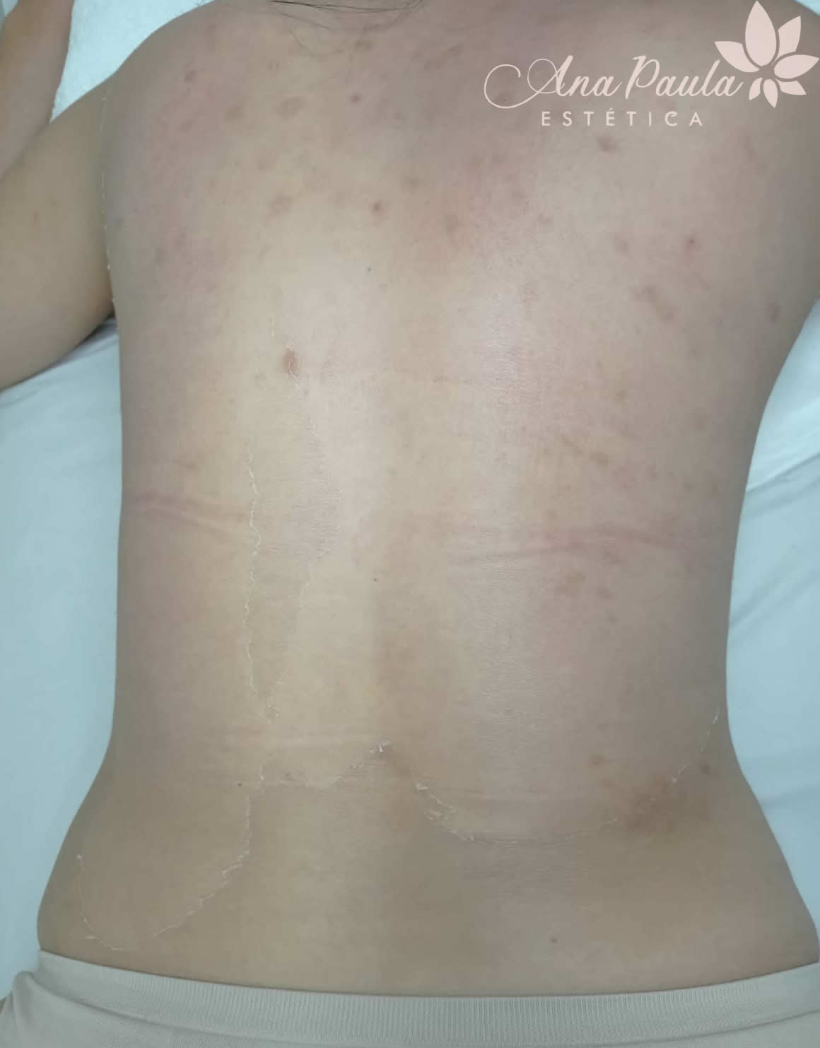 Slider Antes e Depois