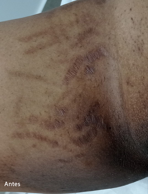 Slider Antes e Depois