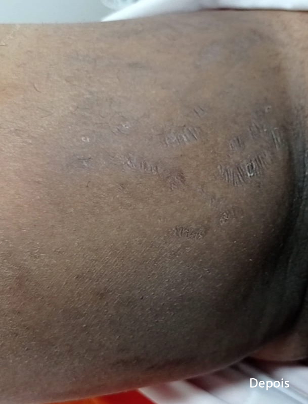 Slider Antes e Depois