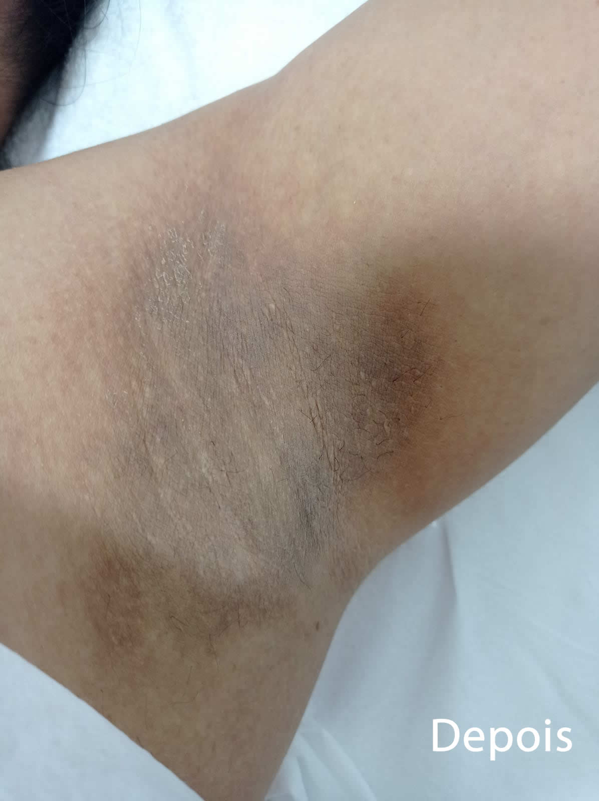 Slider Antes e Depois