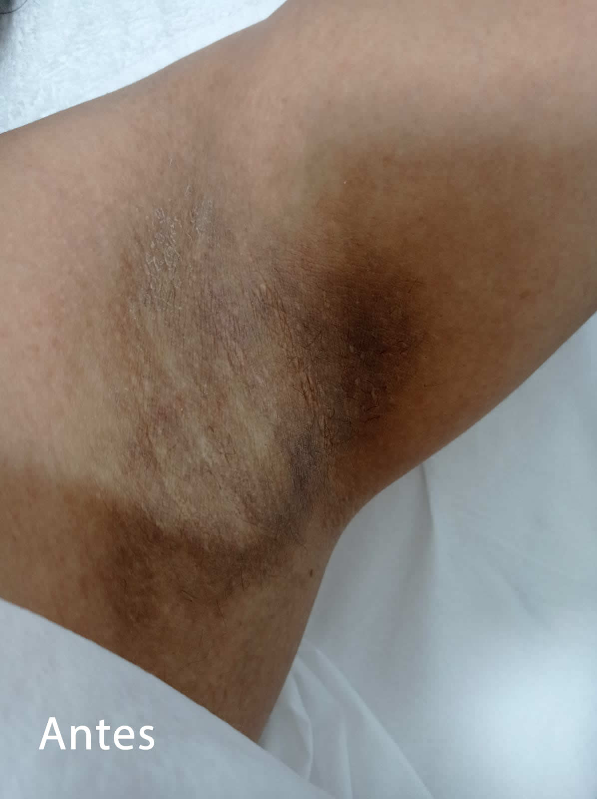 Slider Antes e Depois