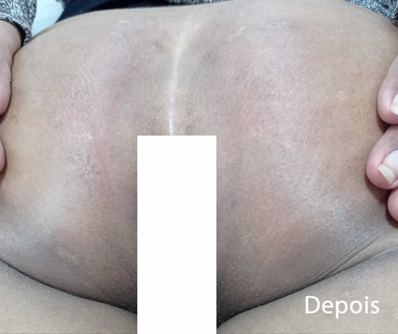 Slider Antes e Depois