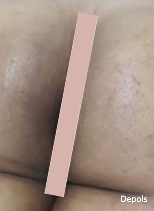 Slider Antes e Depois