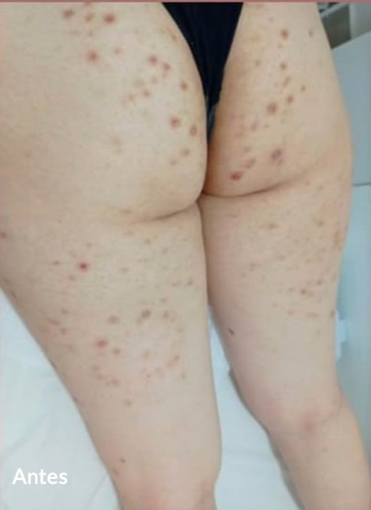 Slider Antes e Depois