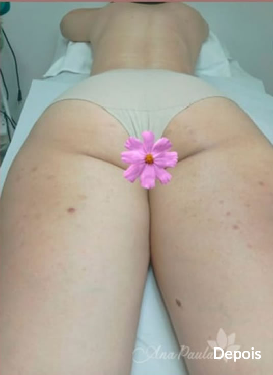 Slider Antes e Depois