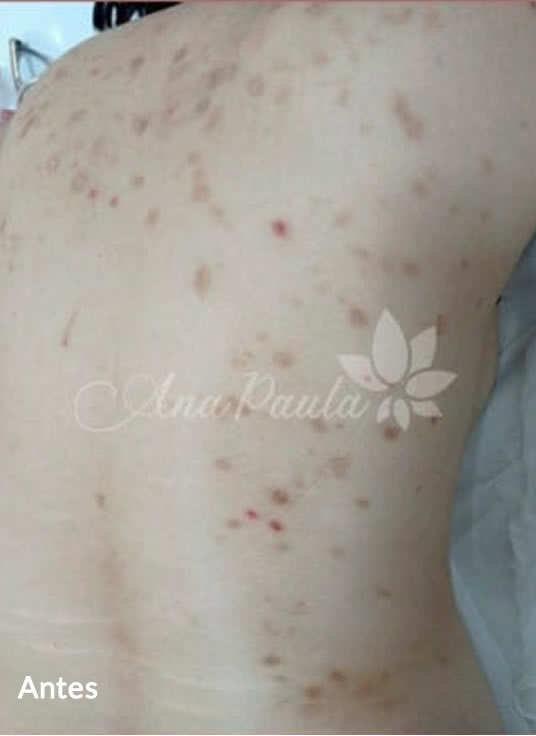 Slider Antes e Depois