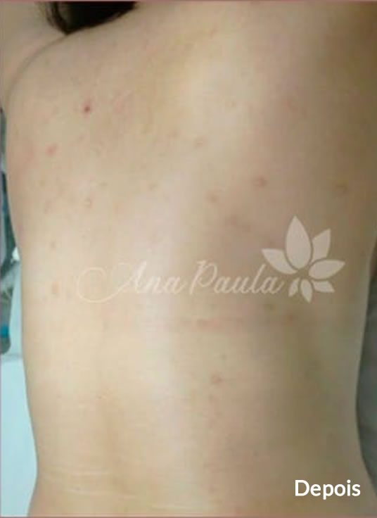 Slider Antes e Depois