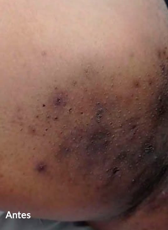 Slider Antes e Depois