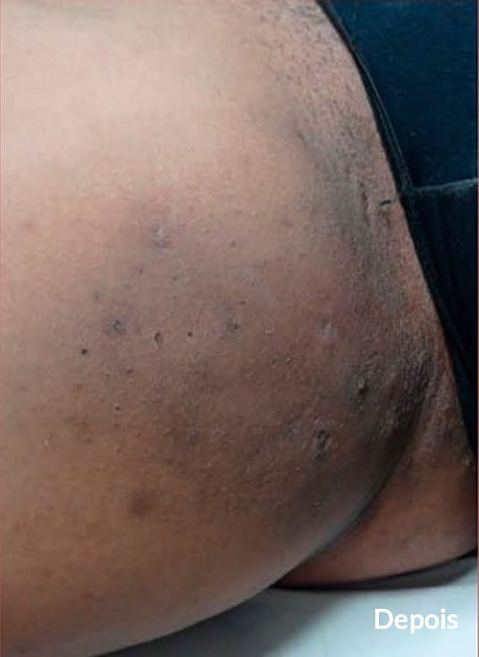 Slider Antes e Depois