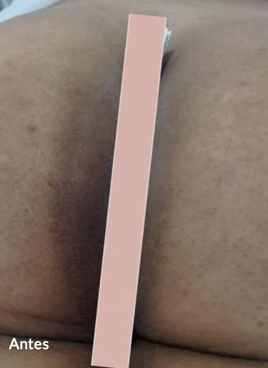 Slider Antes e Depois